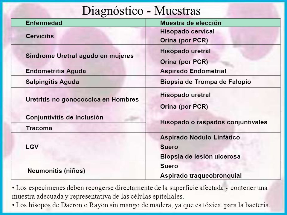 uretritis en hombres en líneas